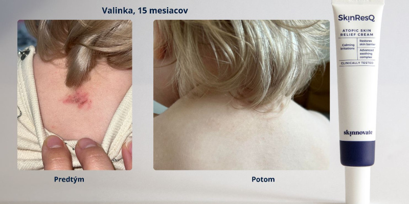 1_Valinka, 15 mesiacov